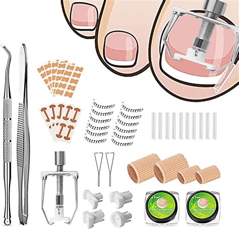 Amazon.com: Ingrown Toenail Removal Kit, Ingrown Toenail Corrector, Ingrown Toenail Tool Kit ...
