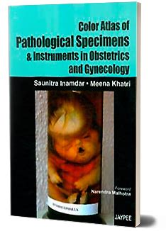 JaypeeDigital | Neural Tube defects