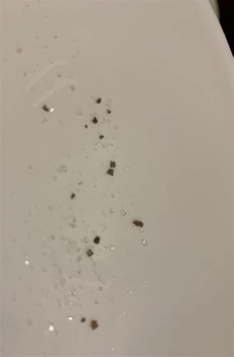 White Specks On Dishes From Dishwasher at Kristian Christenson blog