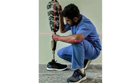 Prosthetics Information for paitent