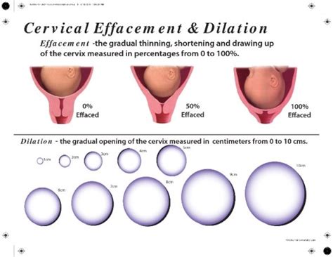 What does thinning of the cervix mean? | BabyCenter
