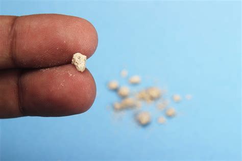 How to Know if You’re Experiencing Kidney Stones - Women's Health Arizona