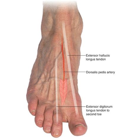 Dorsalis Pedis Pulses Are 1+ at Iva Blackburn blog