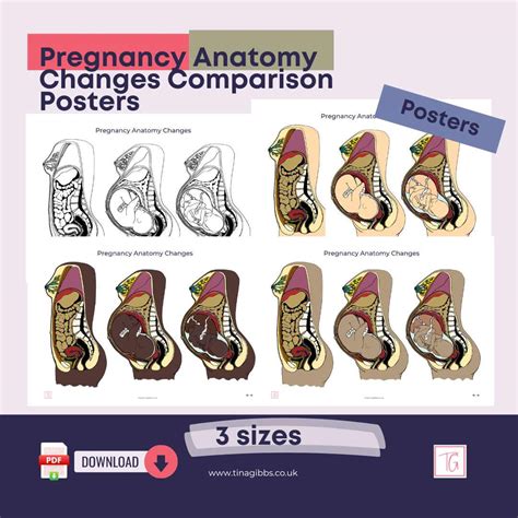 Pregnancy Anatomy Changes Comparison Posters (pdf)