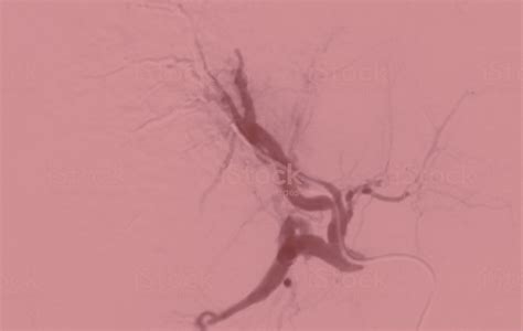 Home - Millennium Medical Imaging