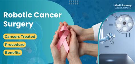 Latest in Cancer Treatment: Robotic Surgery