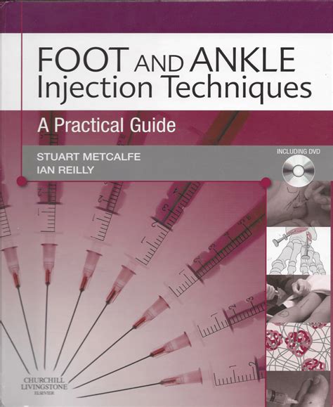 Image result for Ankle Injection Procedure