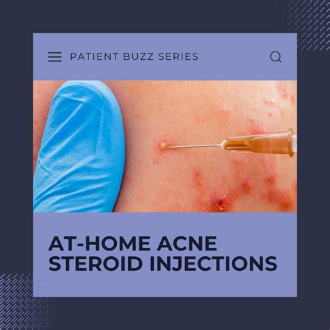 at-home corticosteroid injections acne risks Archives - Next Steps in Dermatology