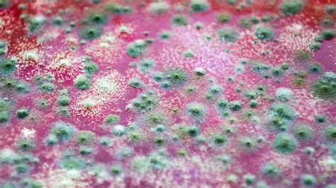 Arizona Witnesses Spike In Valley Fever Cases; Know The Symptoms And ...