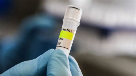 Should you be worried about the hantavirus? Its symptoms and ...