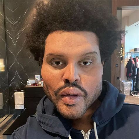 Weekend Face Surgery Before And After - What Happened To The Weeknd S Face Singer Removes ...