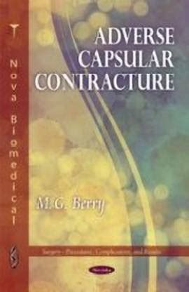 Adverse Capsular Contracture: Buy Adverse Capsular Contracture by Berry ...