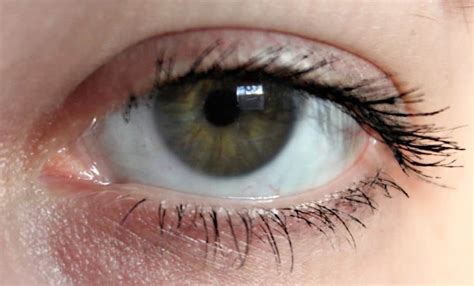 Image result for Common Eye Problems