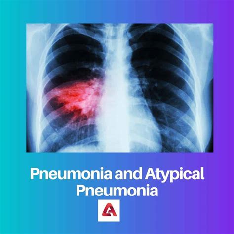 Pneumonia vs Atypical Pneumonia: Difference and Comparison