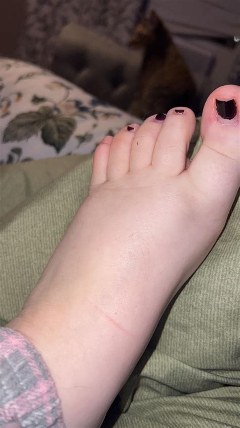 Is this blood pooling? (TW: feet lol) : r/POTS