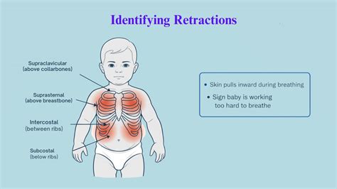 Normal Baby Breathing vs Retractions: Parent Guide - Meredith Plays