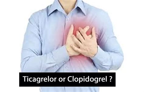 Tricaglor not linked to better outcomes in ACS after PCI compared to ...
