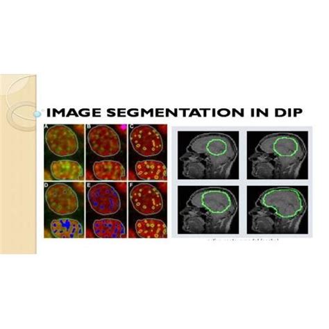 Image result for Medical Image Segmentation MATLAB