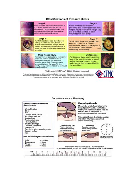 Pressure Ulcer Classifications - Color Version - Classifications of Pressure Ulcers Stage I ...