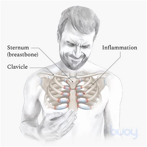 Why Do My Sternum Hurt