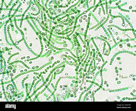 Nostoc Linckia