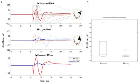 Changes in Cortical Activation by Transcranial Magnetic Stimulation Due ...