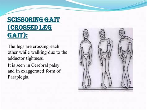 Image result for Contralateral Gait