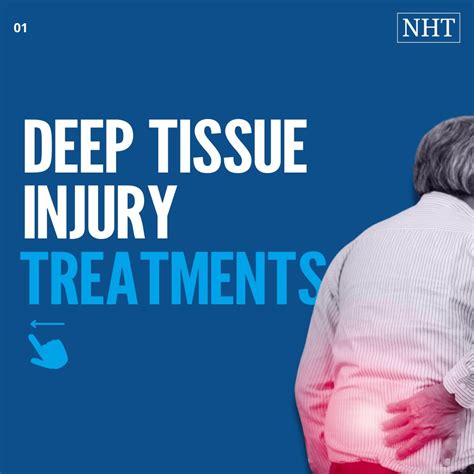 Image result for Deep Tissue Injuries