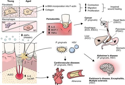 Frontiers | Aging envisage imbalance of the periodontium: A keystone in oral disease and ...