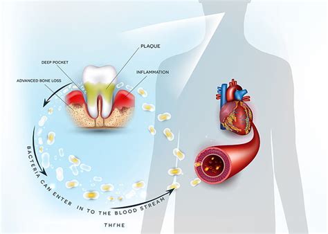 Difficult Tooth Root Extraction 的图像结果