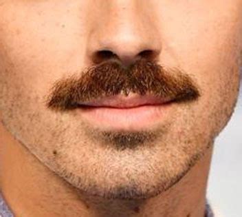 Beard, Moustache, Eyebrow, Facial Hair transplant cost in Ludhiana Punjab