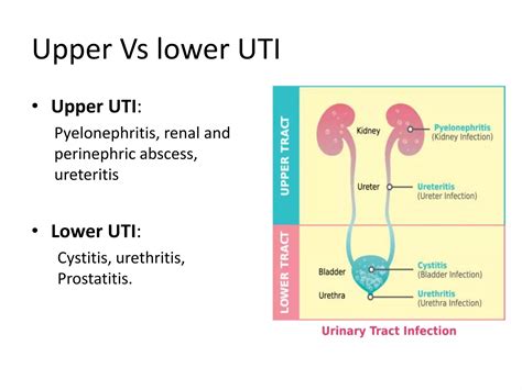 Urinary tract infections | PPTX