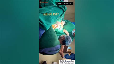 Image result for Labial Reduction Surgery