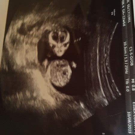 Image result for Alien Ultrasound