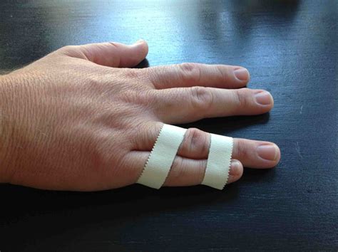 Learn How to Buddy Tape a Finger
