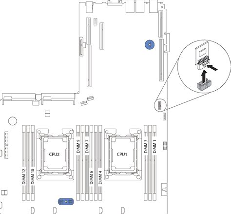 Image result for TCM Replacement