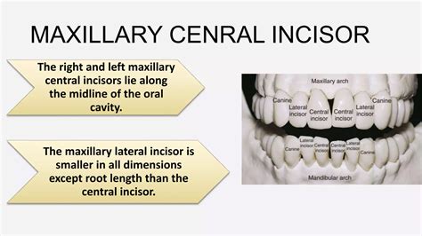 Morphology of Permanent Maxillary Central Incisor- Dr. Saba Arshad.pptx