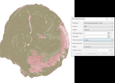 Image result for QuPath Image Analysis