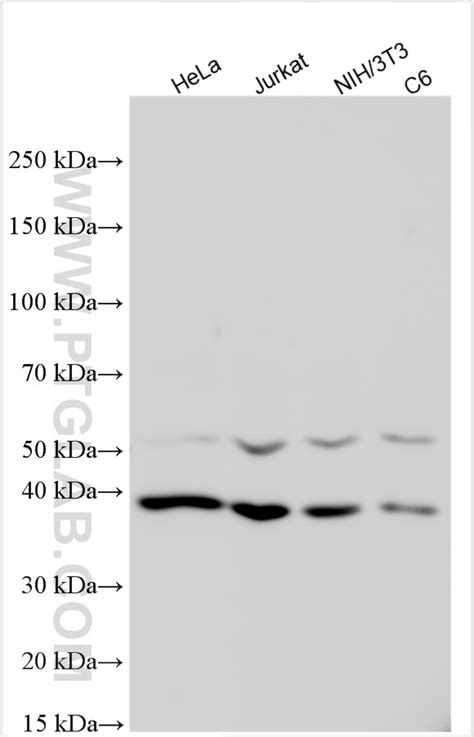 CDK9 antibody (11705-1-AP) | Proteintech