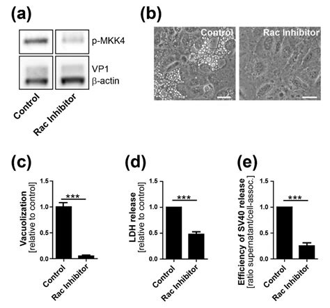 SV40 Polyomavirus Activates the Ras-MAPK Signaling Pathway for ...