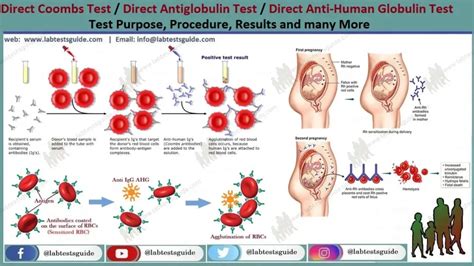 Image result for Coombs Test Positive vs Negative