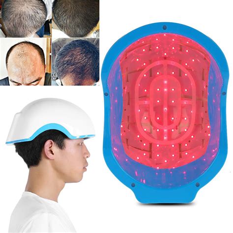 Buy Brrnoo Hair Regrow Cap,80 Diodes Hair Regrow Helmet Fast Growth ...