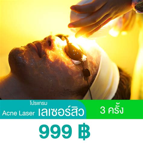 โปรแกรม Acne Laser สิว 3 ครั้ง | LINE SHOPPING
