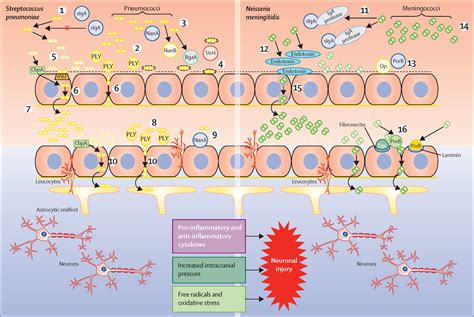Acute bacterial meningitis in adults - The Lancet