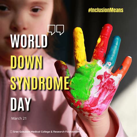 Eye disorders in children with Down syndrome: - SGMC
