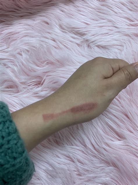 What Is Good For Burns From A Curling Iron at Marion Ohara blog