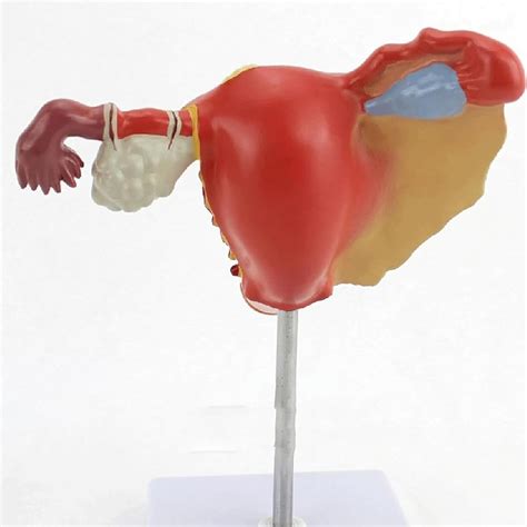 Female Ovarian Model Model Of Pathological Anatomy Of The Uterus ...