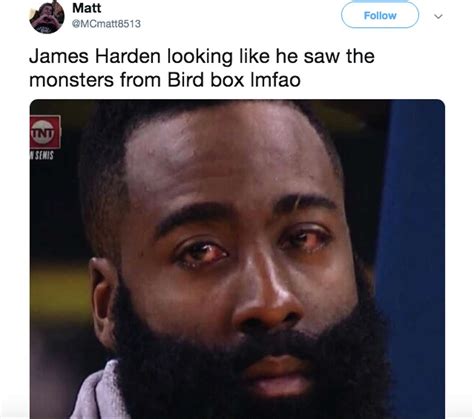 James Harden's extremely bloodshot eyes terrify the internet, spawn memes