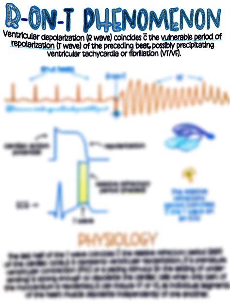 R-on-t Phenomenon - Etsy
