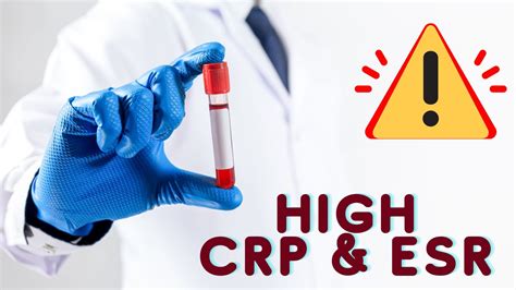 Crp Esr High